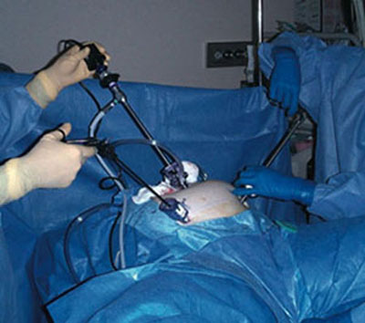 laroscopy